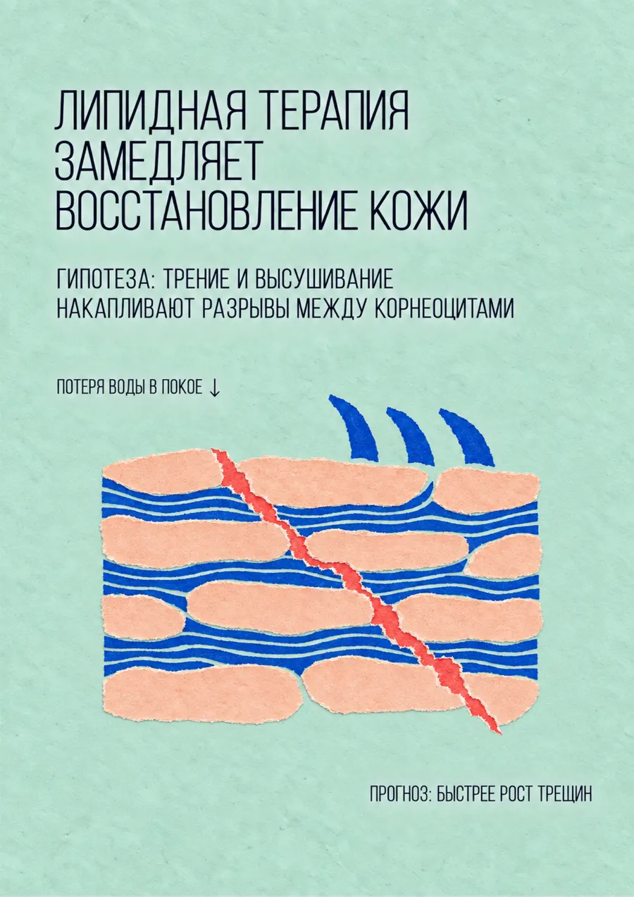 Постер: Липидная терапия замедляет восстановление кожи