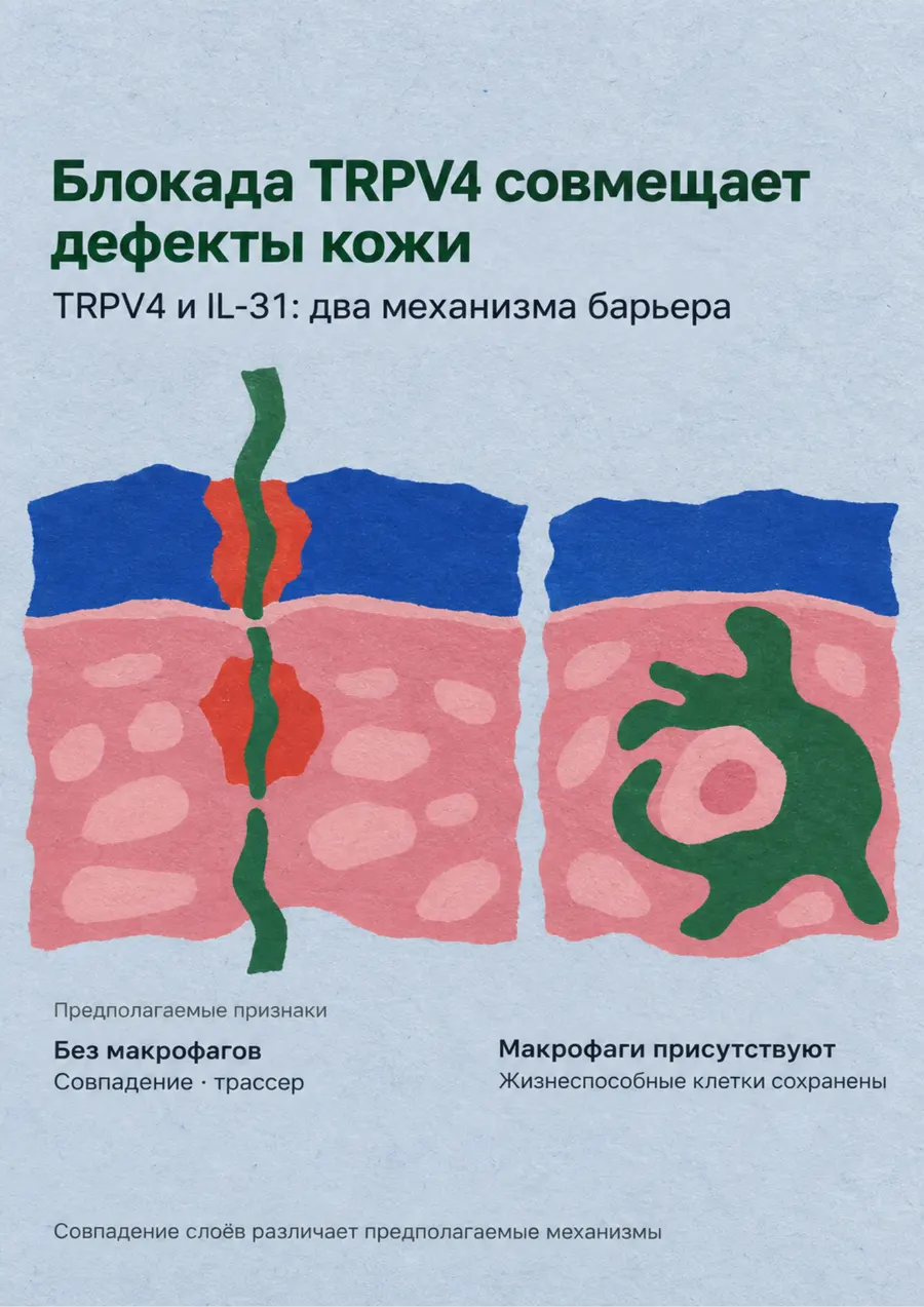 Постер: Блокада TRPV4 совмещает дефекты кожи