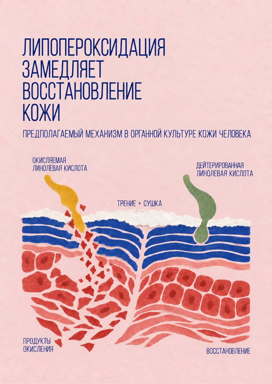 Постер: Липопероксидация замедляет восстановление кожи